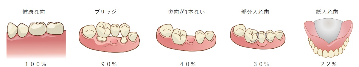 鹿児島　歯医者　噛む力　永田デンタルクリニック
