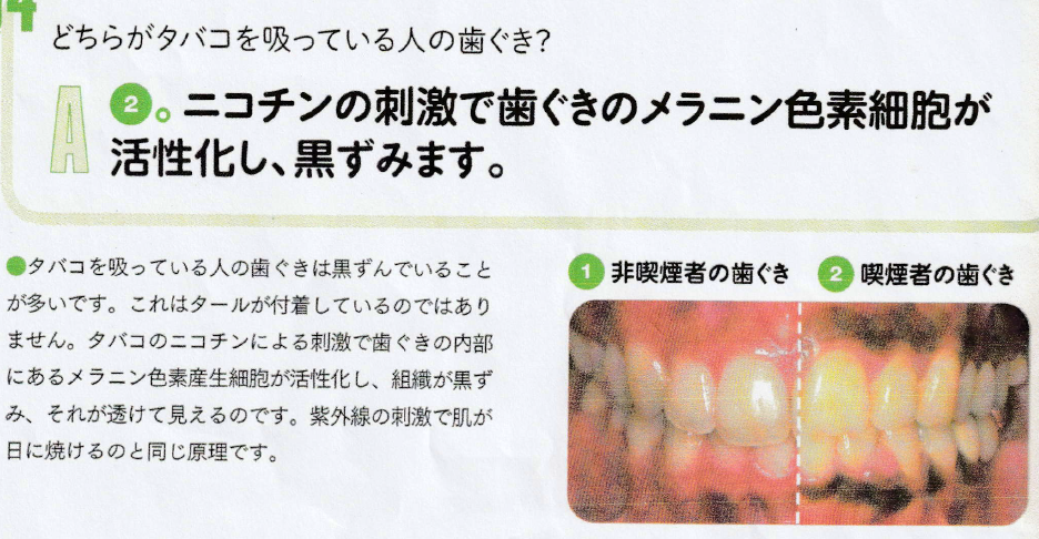 鹿児島　歯医者　歯周外科やインプラントなどの外科治療の前には禁煙をおすすめ
