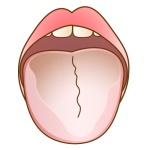 鹿児島　歯医者　舌苔が茶色っぽい