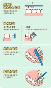 鹿児島　歯医者　ブラシング方法