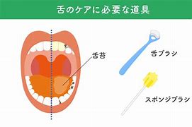 鹿児島　歯医者　軟毛歯ブラシで舌の奥から手前へ10回軽く擦り、舌苔を擦りとる