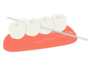 鹿児島　歯医者　フロスと歯間ブラシの扱い