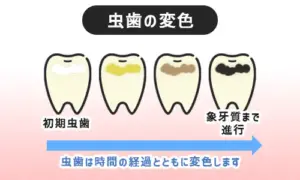 鹿児島　歯医者　マウスウォッシュ