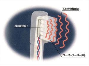 鹿児島　歯医者　超音波歯ブラシ