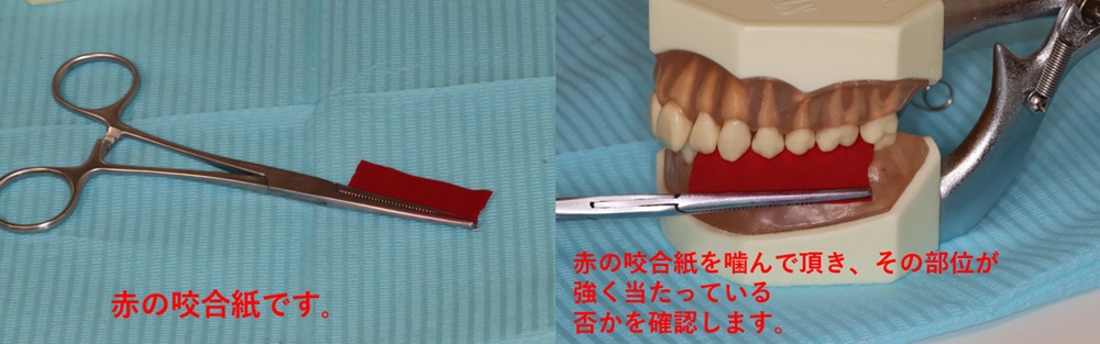 咬合紙