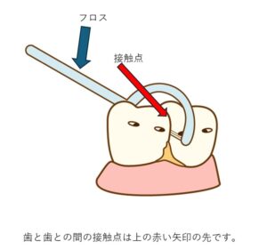 フロス