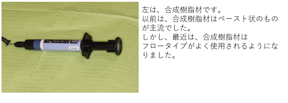 鹿児島　歯医者　合成樹脂材を歯に詰め