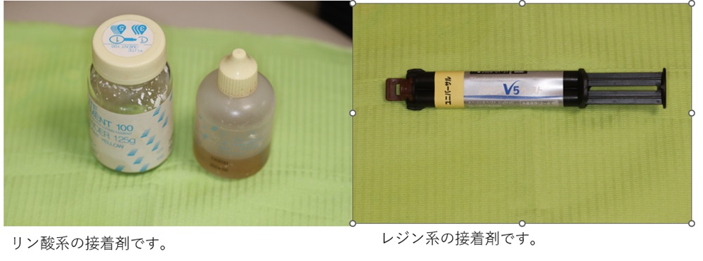 鹿児島 歯医者 接着剤