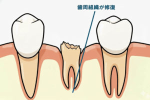 鹿児島 歯医者 歯の破折