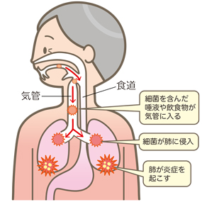 鹿児島　歯医者　咀嚼回数と嚥下直前の食塊は嚥下に影響する
