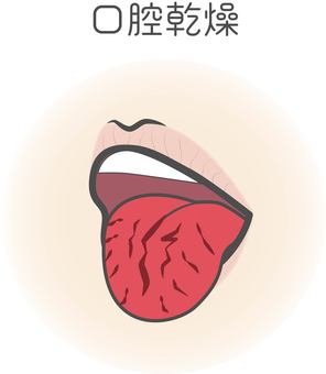 鹿児島 歯医者 口腔乾燥