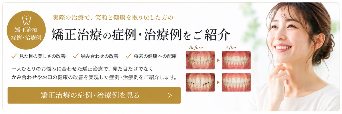 矯正治療の治療・症例